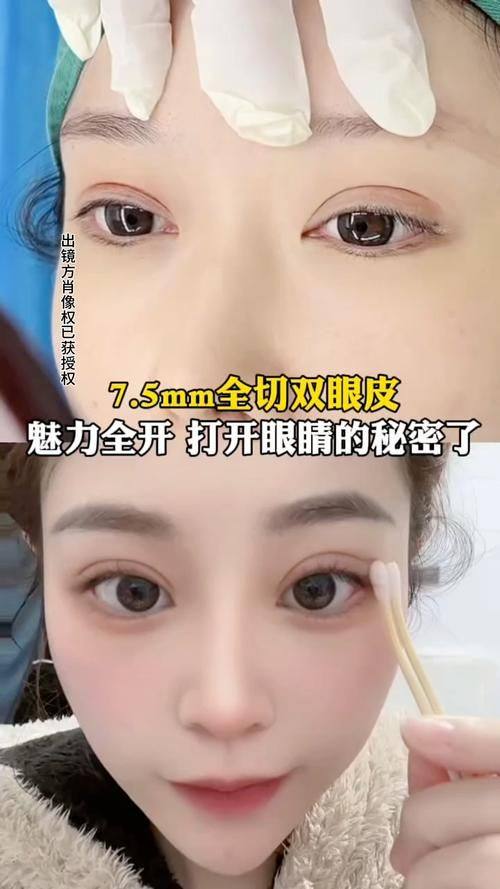 杭州德米尔医疗美容诊所真人口碑评价怎么样？