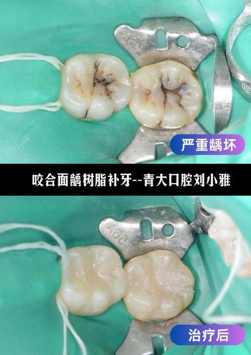 山东泰安天畅口腔收费价格表/收费标准