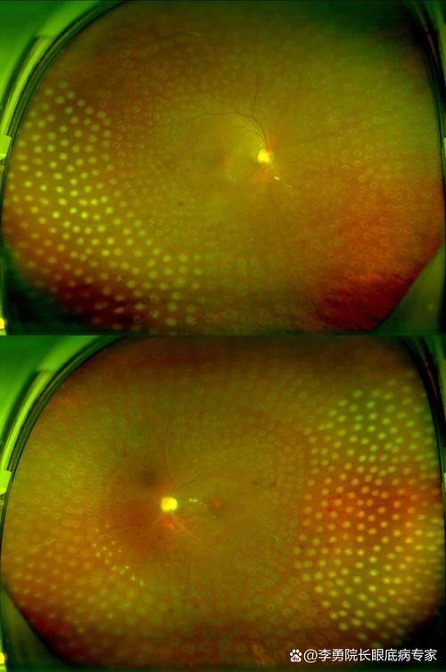 山东省立第三医院眼科收费价格表/收费标准