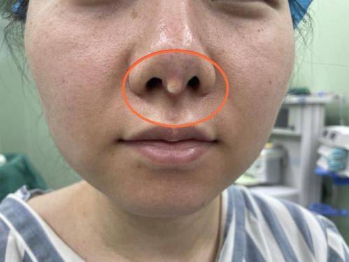 成都颜美汇整形医疗美容诊所真人口碑评价怎么样？