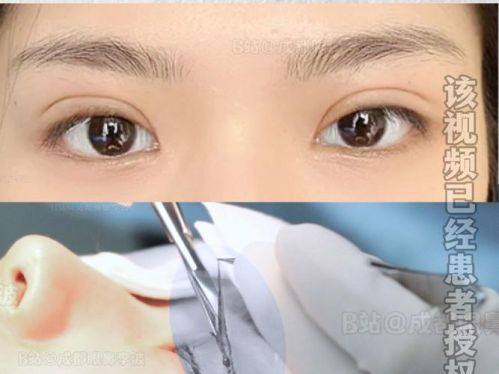 天津南开区痘博士医疗美容门诊部是正规医院吗？