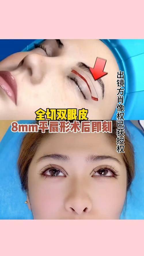 杭州芘丽芙医疗美容门诊部详细的预约挂号方式及流程