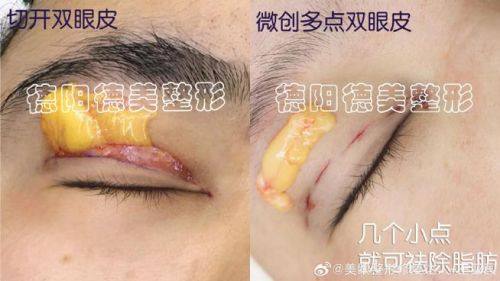 天津南开区痘博士医疗美容门诊部收费价格表/收费标准