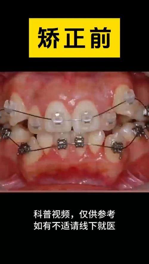 湖南长沙兴瑞口腔是正规医院吗?