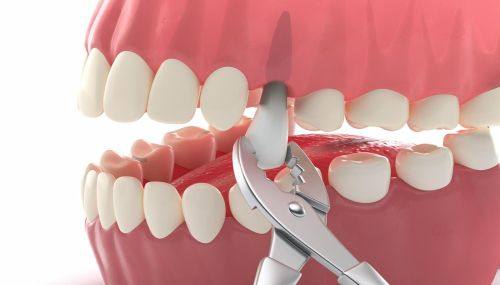 宁波甬盛康铭口腔特色项目及技术优势