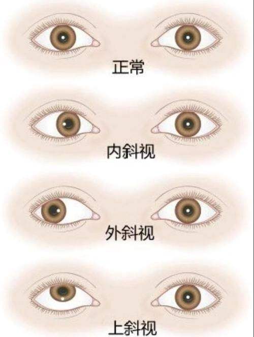 浙大二院眼科中 心特色项目及技术优势