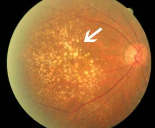 云南省第三人民医院眼科收费价格表/收费标准