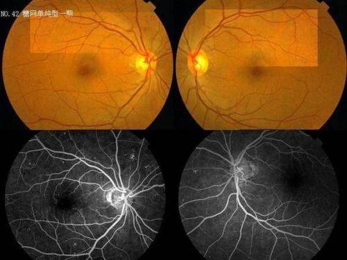 云南省第三人民医院眼科地址电话营业时间
