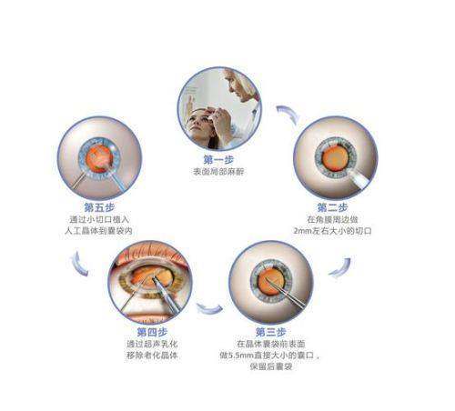 浙大二院眼科中 心医生团队实力强大及骨干医生简介