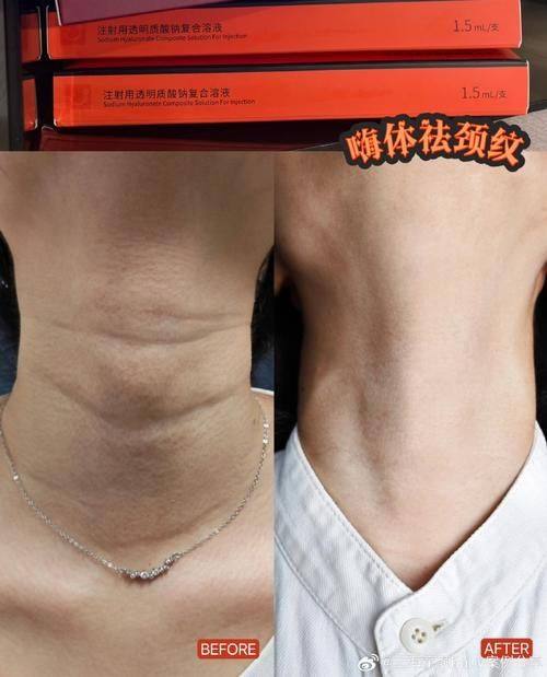 杭州芘丽芙医疗美容门诊部真人口碑评价怎么样？