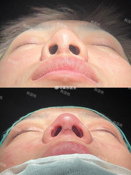 天津南开区痘博士医疗美容门诊部真人口碑评价怎么样？