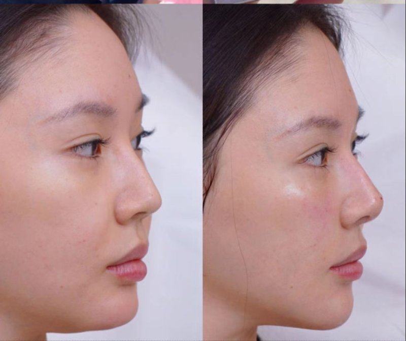 绵阳市人民医院烧伤整形科详细的预约挂号方式及流程