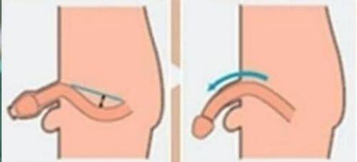 厦门大学附属第一医院真人口碑评价怎么样？