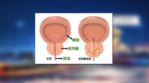 厦门大学附属第一医院详细的预约挂号方式及流程