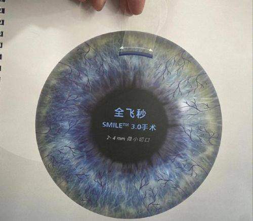 丰城爱尔眼科医院怎么样