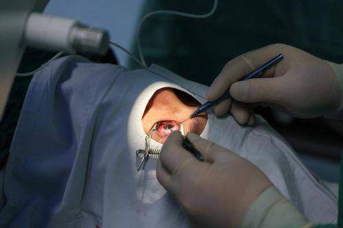 丰城爱尔眼科医院是正规医院吗？