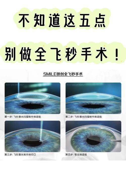 丰城爱尔眼科医院详细的预约挂号方式及流程