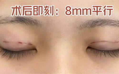 武汉爱尔丽医疗美容门诊部是正规医院吗?