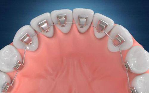 启东众邦口腔诊所真人口碑评价怎么样？