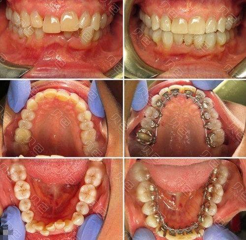 黑龙江哈尔滨诚奥口腔是正规医院吗？