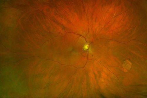 辽源市中医院眼科详细的预约挂号方式及流程