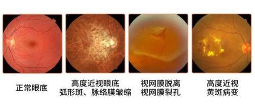 淮南市第一人民医院眼科真人口碑评价怎么样？