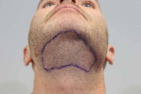 佛山医美恩整形医院是正规医院吗？