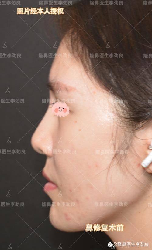 佛山医美恩整形医院真人口碑评价怎么样？