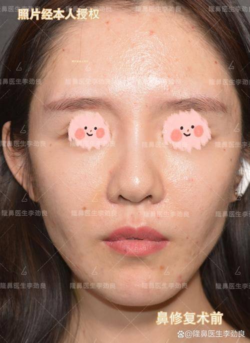 天津市芝洺医疗美容门诊详细的预约挂号方式及流程