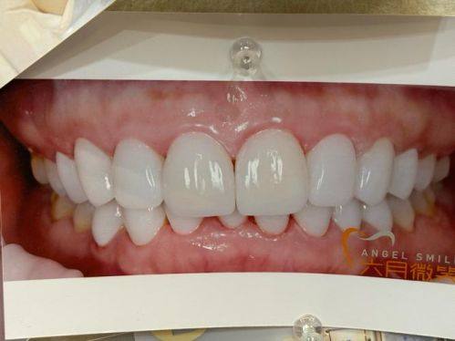 衡阳齿悦口腔是正规医院吗?