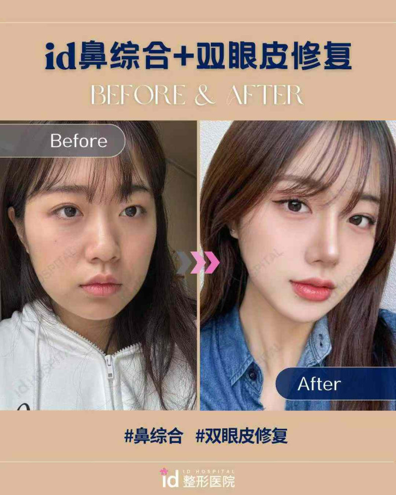 佛山医美恩整形医院收费价格表/收费标准