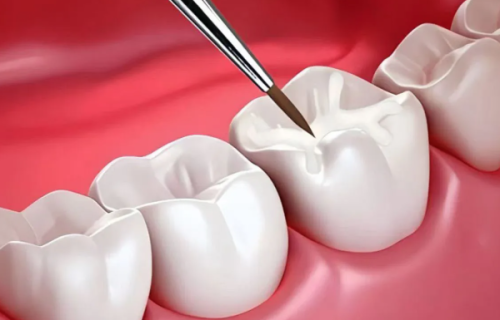 郑州植得口腔医院特色项目及技术优势