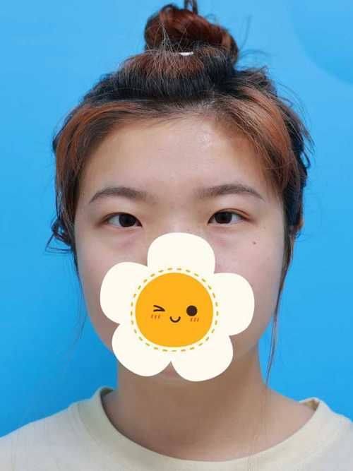 韩国普罗菲耳整形医院是正规医院吗?