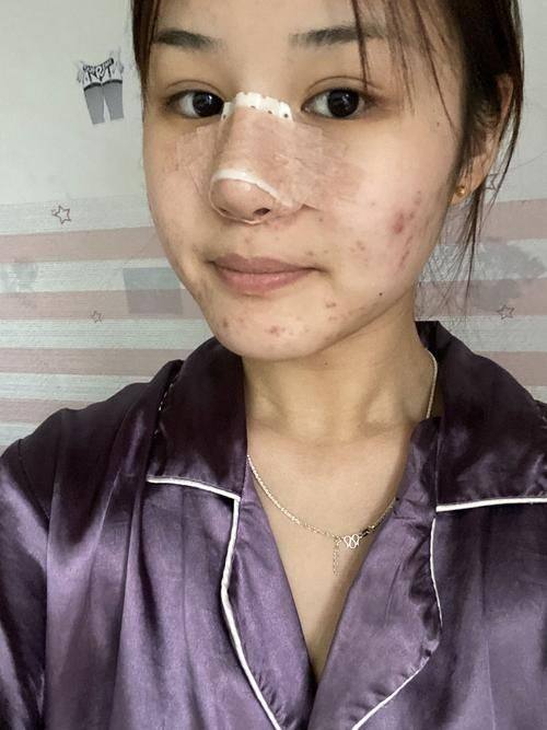 韩国普罗菲耳整形医院收费价格表/收费标准