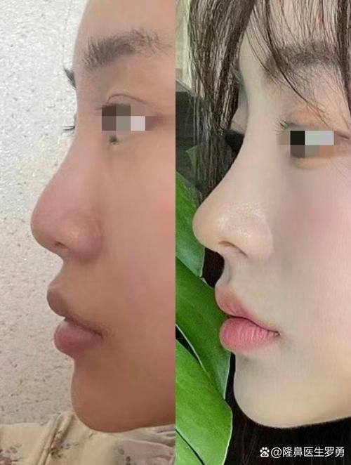 天津河东圣韩美整形医疗美容医院详细的预约挂号方式及流程