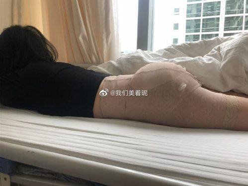 深圳市第二人民医院烧伤整形科收费价格表/收费标准