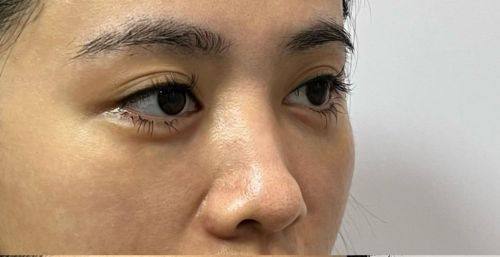 韩国普罗菲耳整形医院真人口碑评价怎么样?