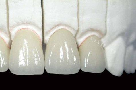 郑州植得口腔医院详细的预约挂号方式及流程