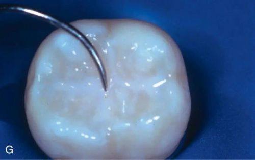 郑州植得口腔医院是正规医院吗？