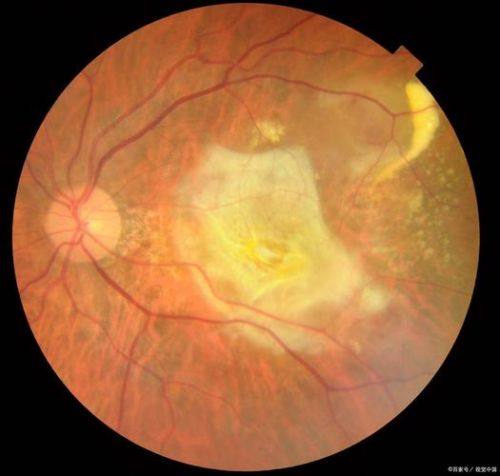 山东省立第三医院眼科特色项目及技术优势