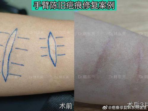 天津河东圣韩美整形医疗美容医院是正规医院吗？