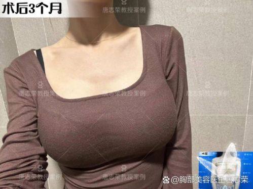 韩国普罗菲耳整形医院详细的预约挂号方式及流程