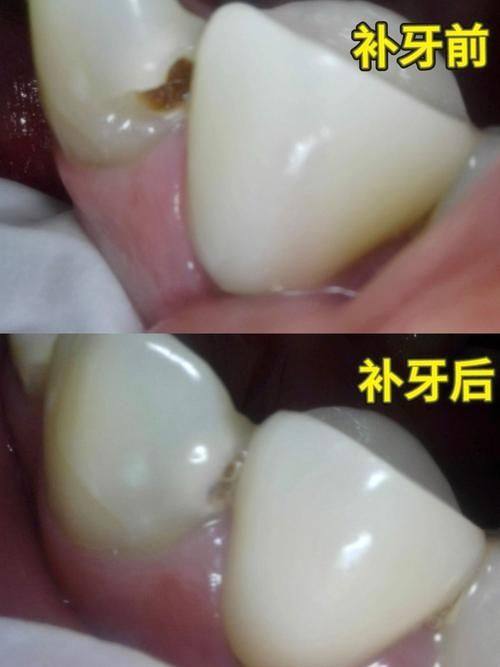 江苏苏州常州益达口腔真人口碑评价怎么样?