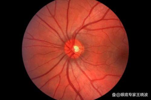 温州医 科 大学附属第二医院眼科收费价格表/收费标准