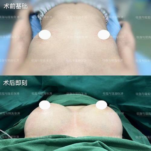 汕头大学医学校第一附属医院整形美容外科真人口碑评价怎么样？