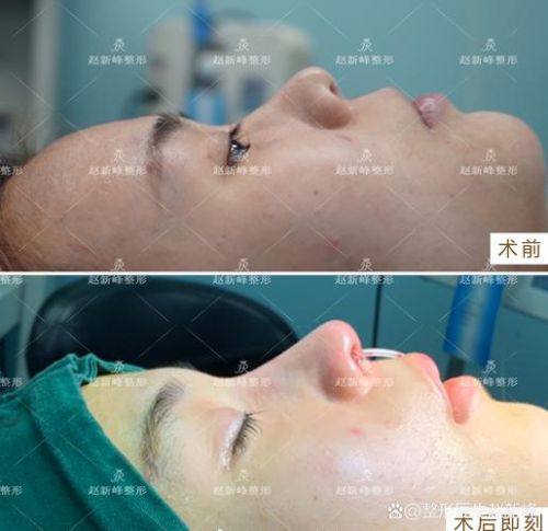 汕头大学医学校第一附属医院整形美容外科是正规医院吗？