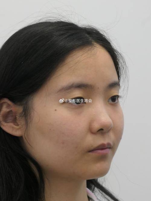 广东深圳华晟时代整形医院详细的预约挂号方式及流程