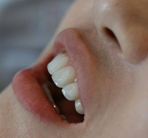 宿迁丽和口腔诊所真人口碑评价怎么样?