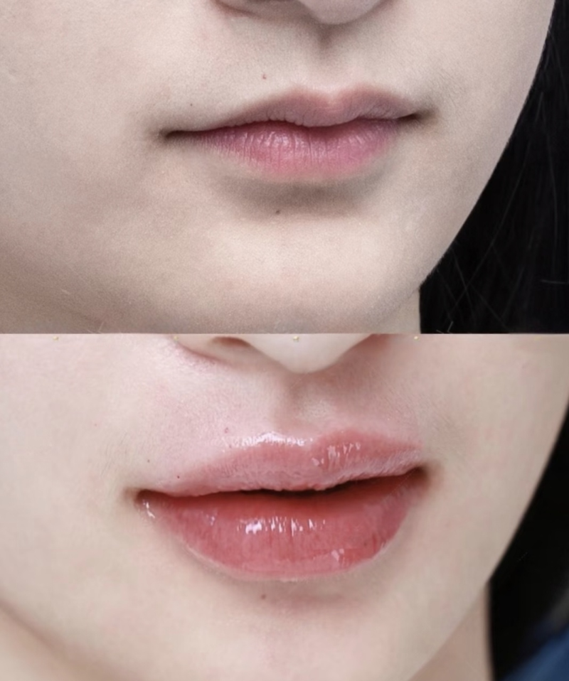 广东深圳华晟时代整形医院收费价格表/收费标准