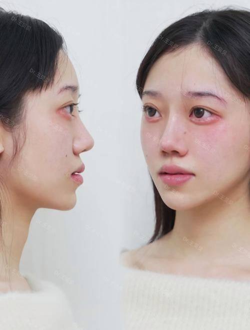 哈尔滨美尚线整形医疗美容门诊部详细的预约挂号方式及流程